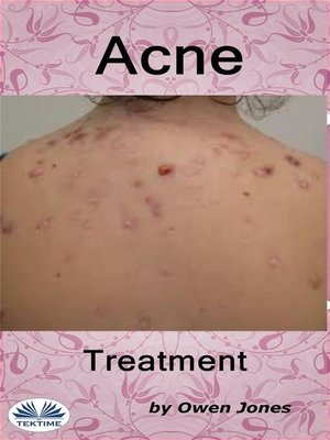 cover image of Acne Treatment